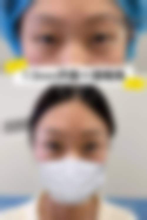 北京轻美颜（眼袋提升）医疗美容门诊部口碑如何？