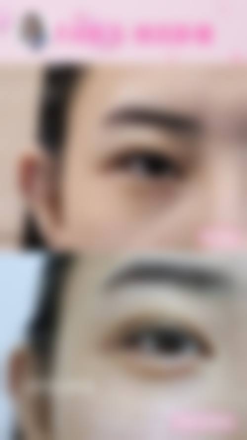 擅长项目详解