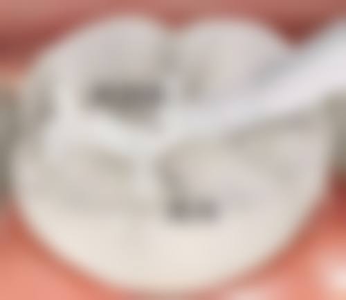 结语:值得信赖的口腔健康管家