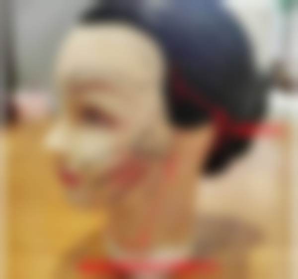 北京黄寺医美Inmode钻石超塑下颌缘+双下巴射频紧肤还有哪些免费补贴?