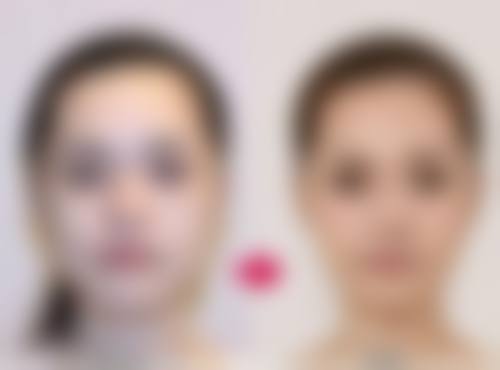 总结——昆明美诚均美医疗美容诊所怎么样?