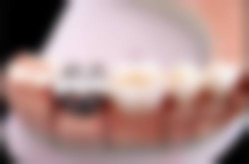 临床实例分享
