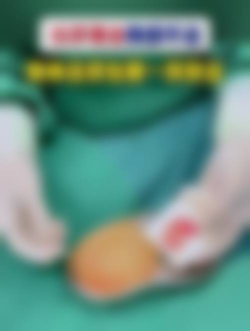 优惠活动详情