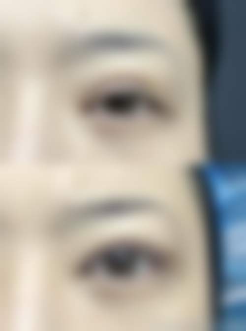 八、上海悦欧医疗美容门诊部用户真实实例