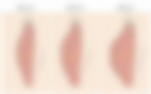 临床实例分享