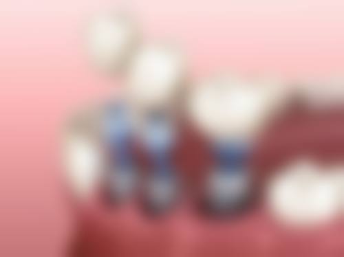 三、陈思医生在口腔领域技术特长