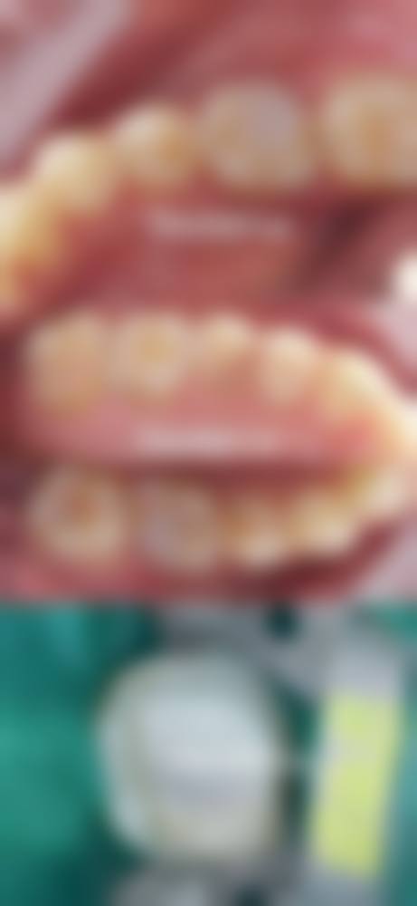 预约优惠活动