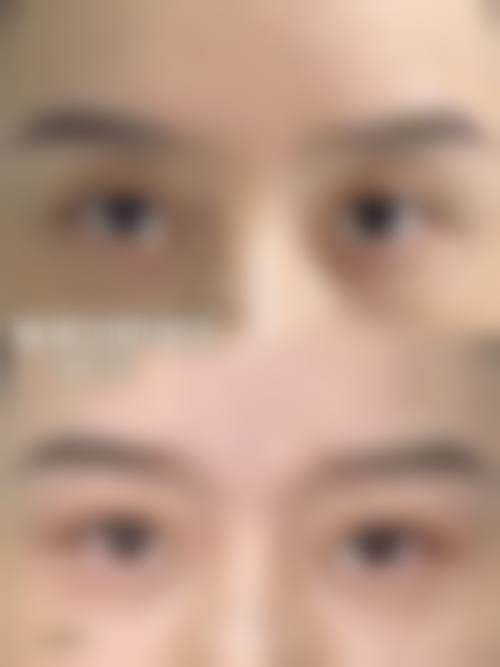 临床实例分享