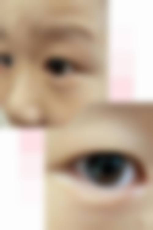 眼科诊疗优势与服务特色