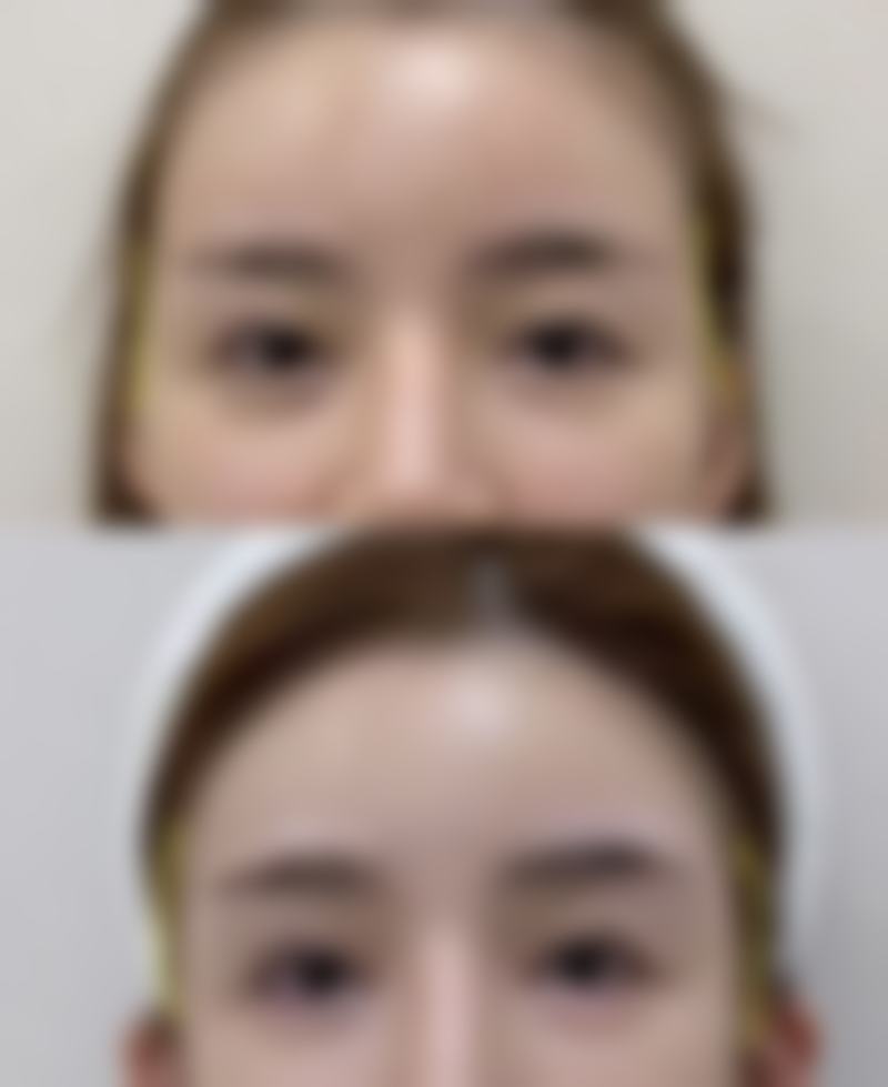 郑州郑美整形收费标准参考