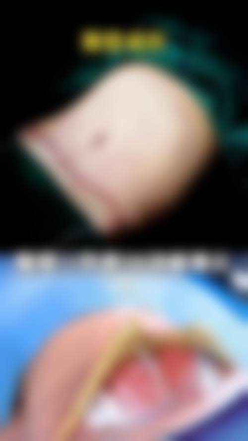 服务流程与患者权益:安心无忧的整形体验