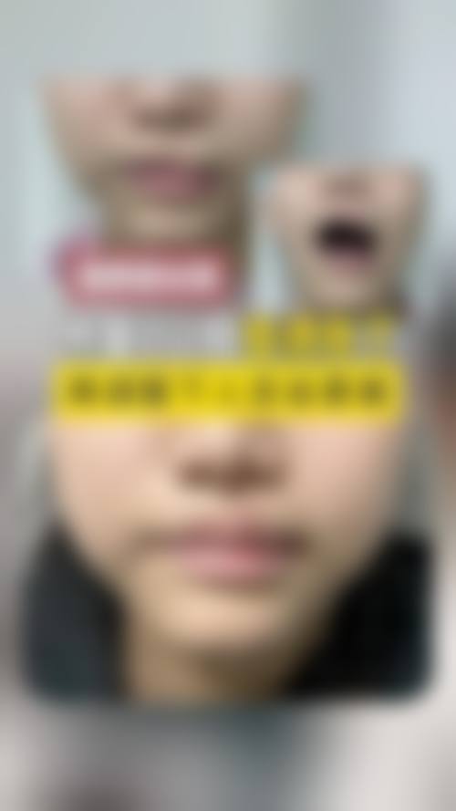 设备环境介绍:安心效率高的手术保护